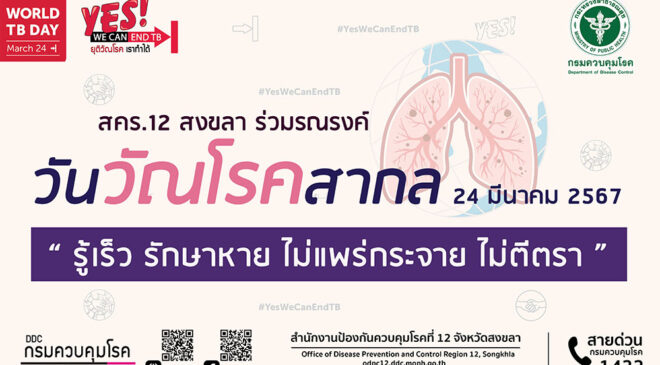 สคร.12 สงขลา ร่วมรณรงค์ วันวัณโรคสากล 24 มีนาคม 2567